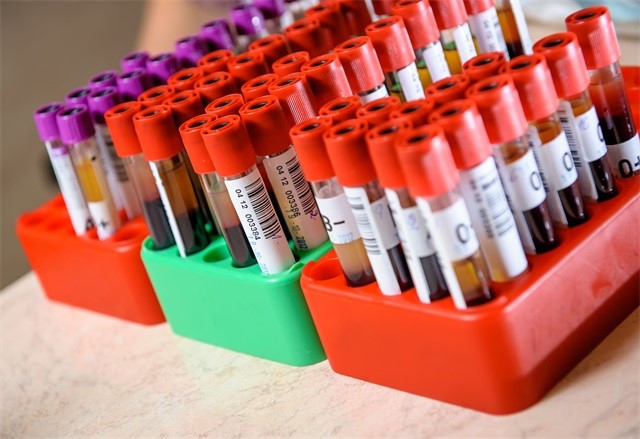 血液、抽血、体检、乳糜血-康兴医疗器械官网