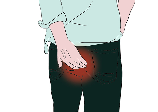 男士-痔疮_画板-1w适应.jpg